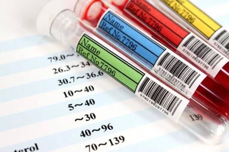 Биохимический анализ крови (форма 228/у)